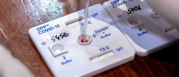 medicamento pode ser capaz de reduzir chance de forma grave de covid.jpg